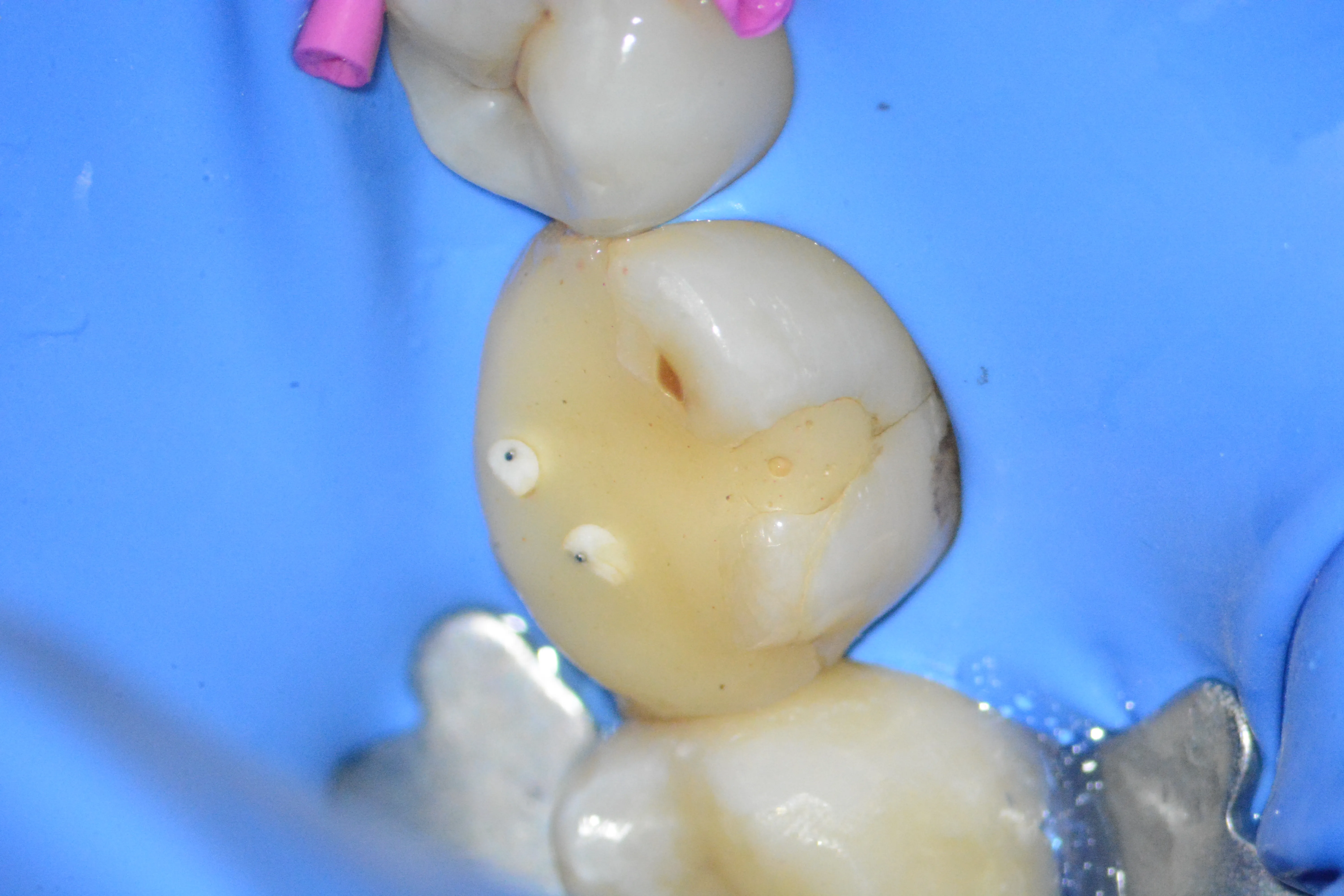 1 – Situație clinică inițială