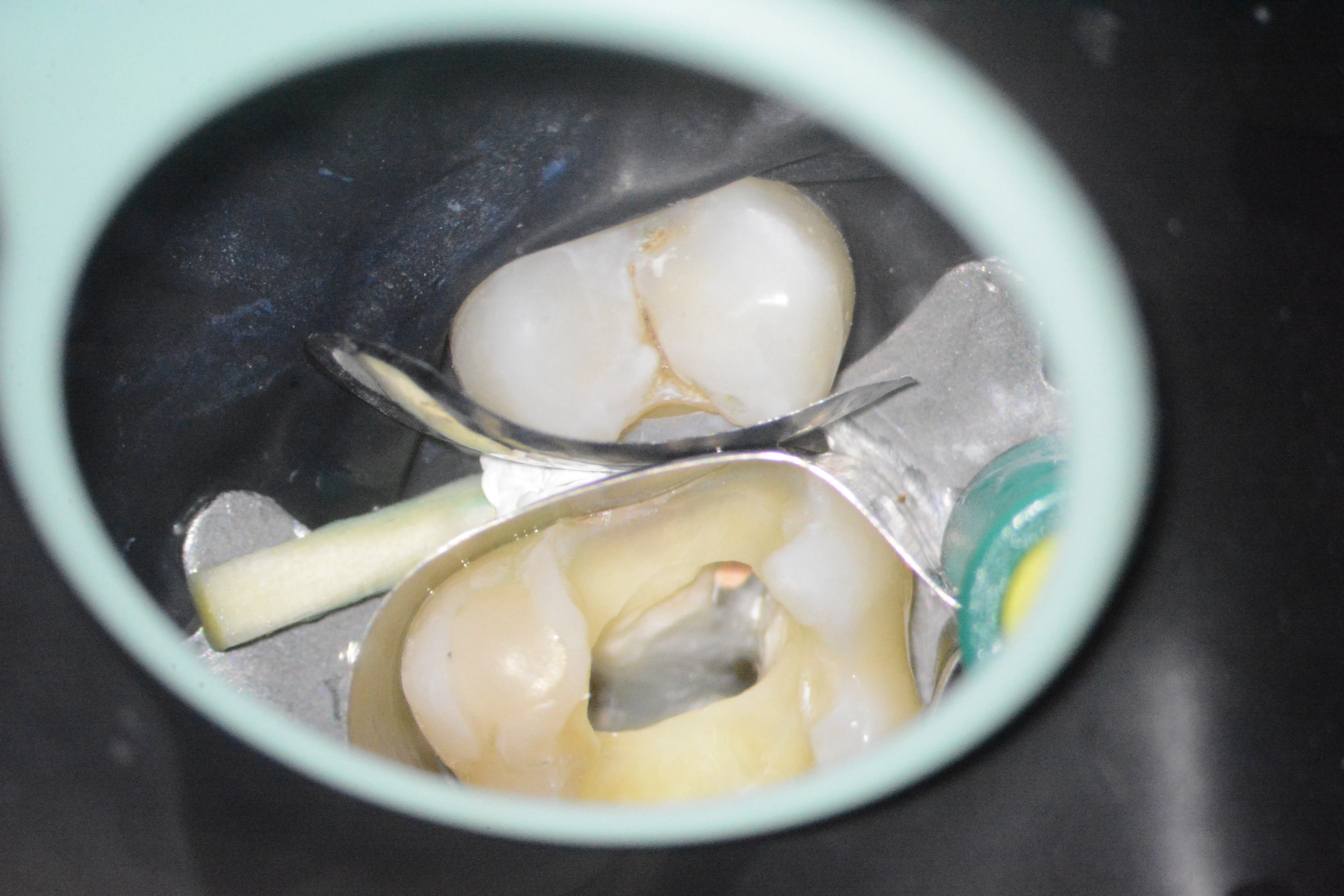 12 – Aplicarea sistemului de matrici