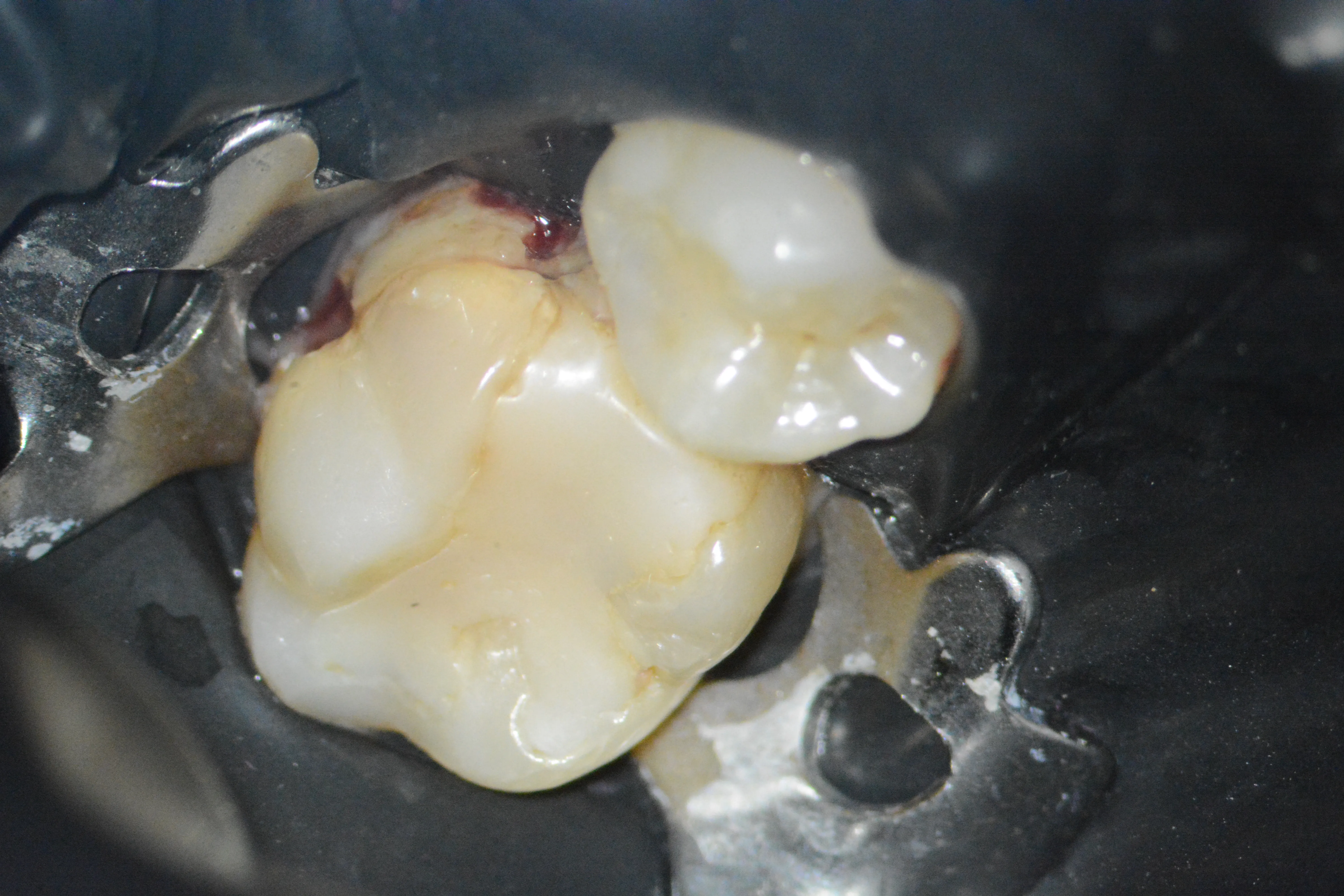 2 – Aspect clinic inițial