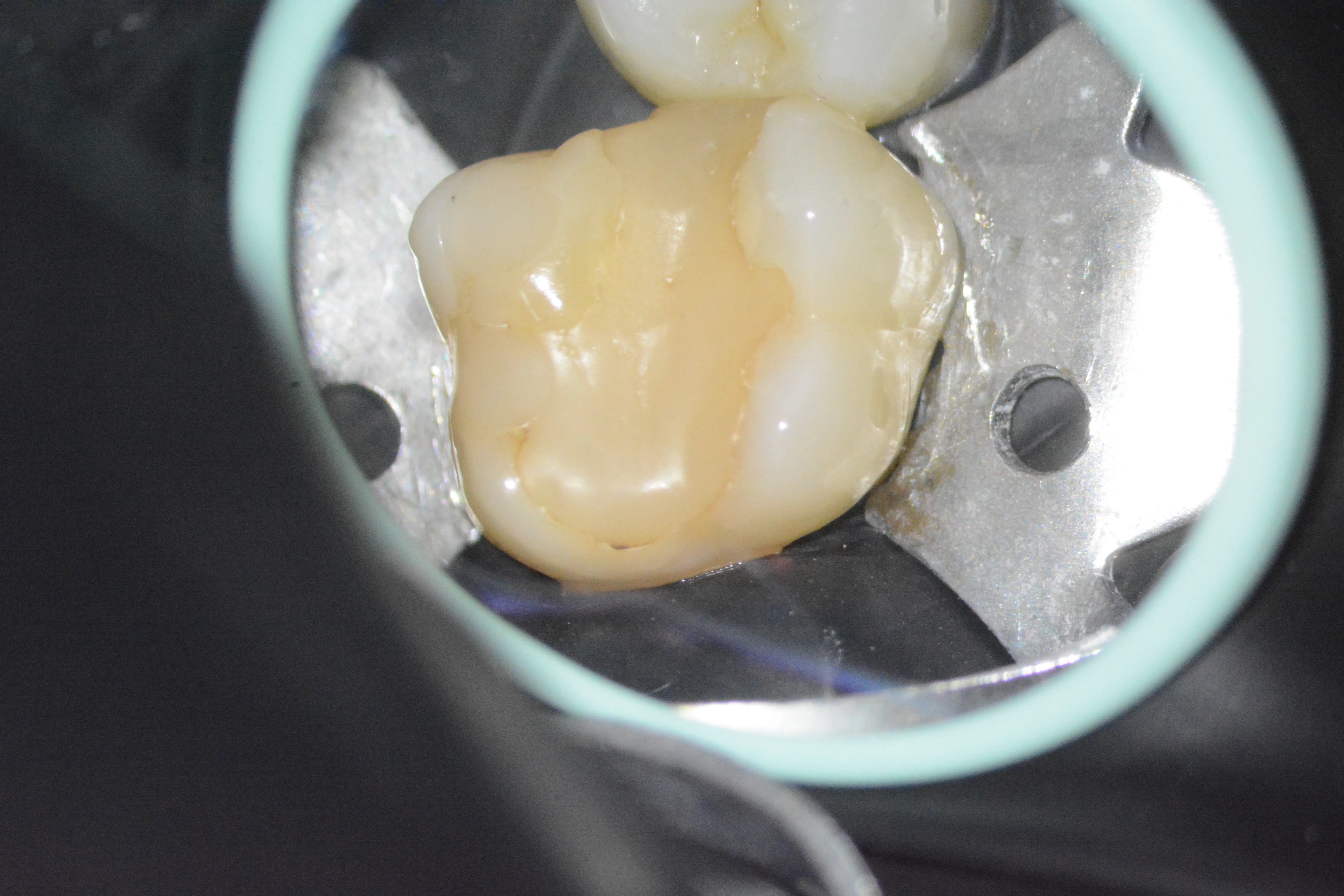 2 – Aspect clinic inițial