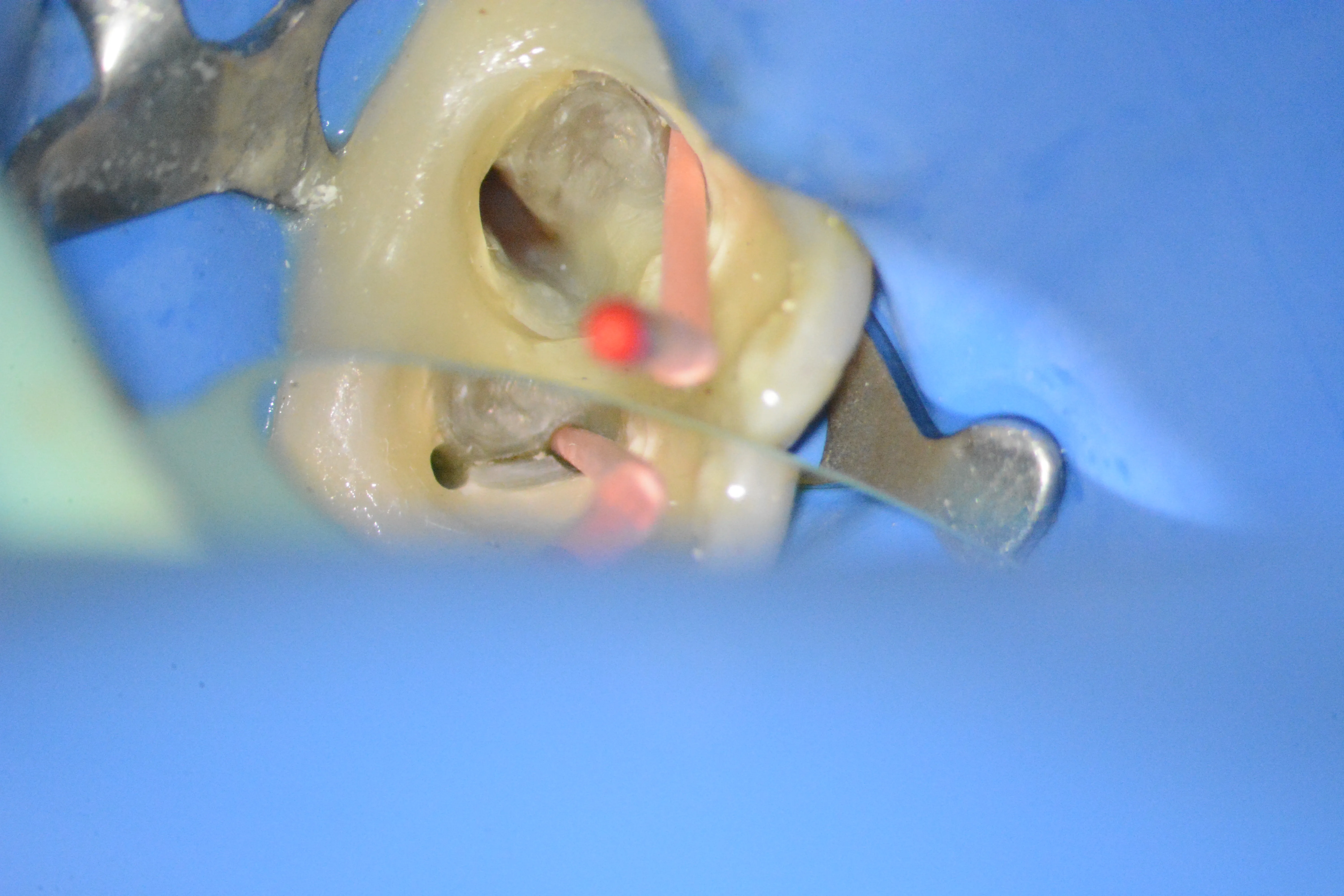 9 – Stabilirea conurilor master